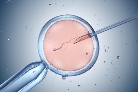 IVF Treatment in Delhi