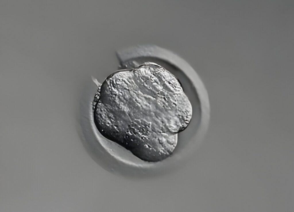Advantages of Laser-Assisted Hatching Treatment