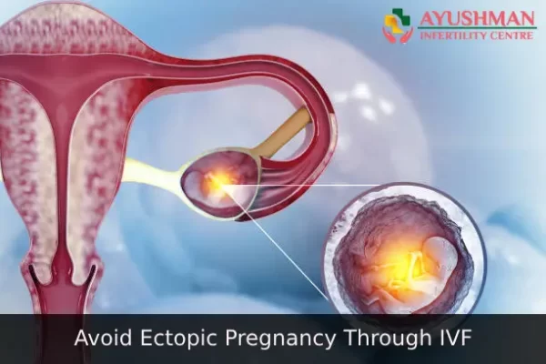 How To Avoid Ectopic Pregnancy Through IVF