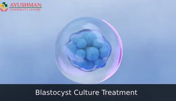 Best Blastocyst Culture Treatment in Dwarka, Delhi