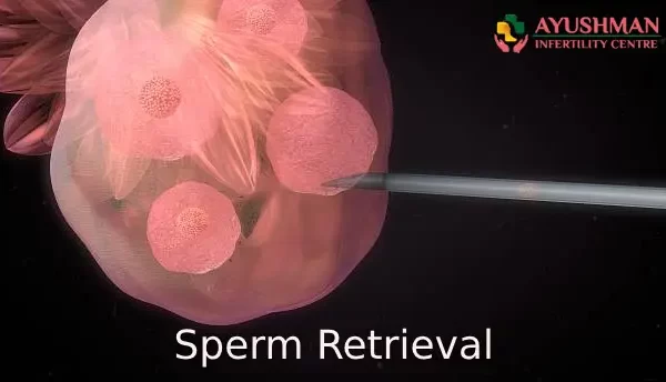 Why and When is Sperm Retrieval Done?