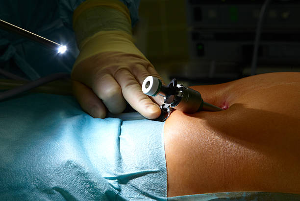 Benefits-of-Laparoscopy