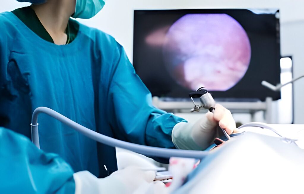 Laparoscopy treatment in delhi