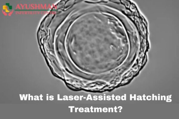 What is Laser-Assisted Hatching Treatment?
