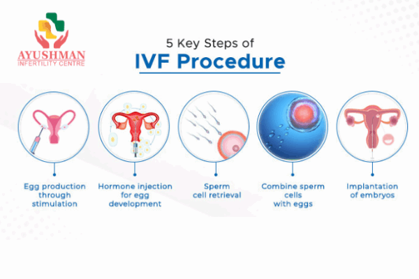 Understanding the 5 Stages of IVF – A Simple Guide for Couples